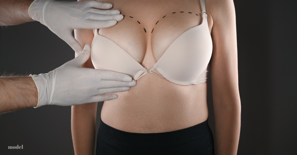 Four Options after Removing Breast Implants