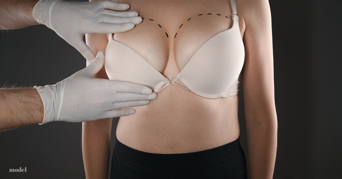 What Kind and Size of Breast Implants are Right for Me? - Dr